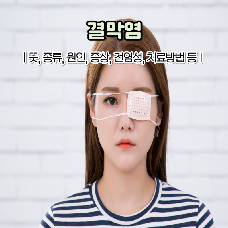 결막염 원인 증상 결막염 전염성 치료법은?