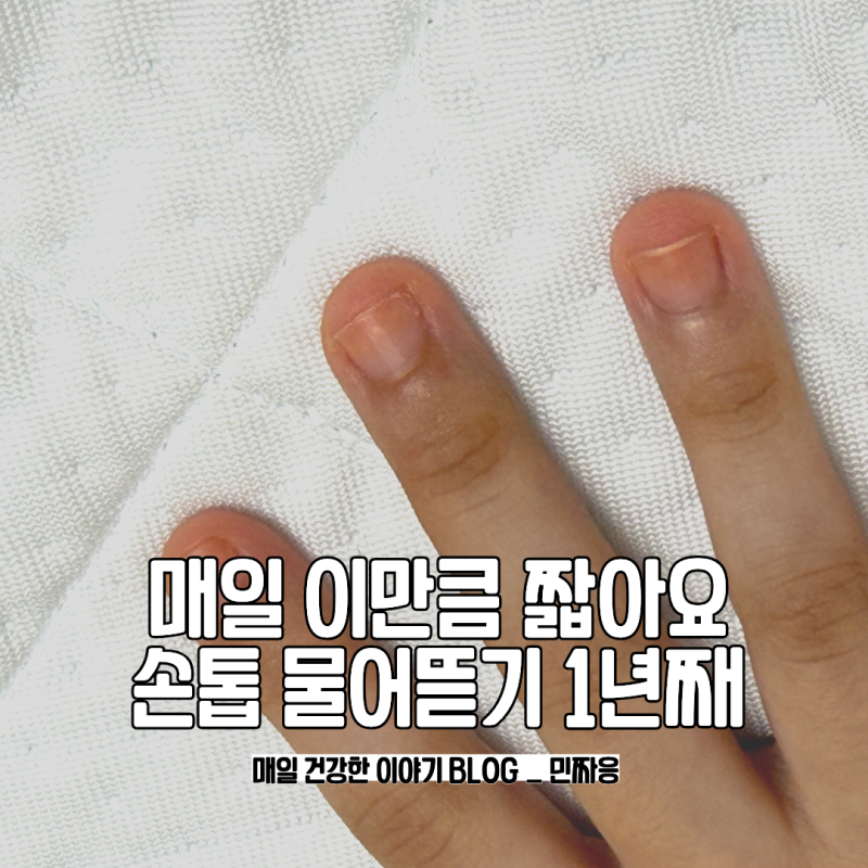 7살 아이 손톱 물어뜯기 1년째 매일 손톱이 짧아요