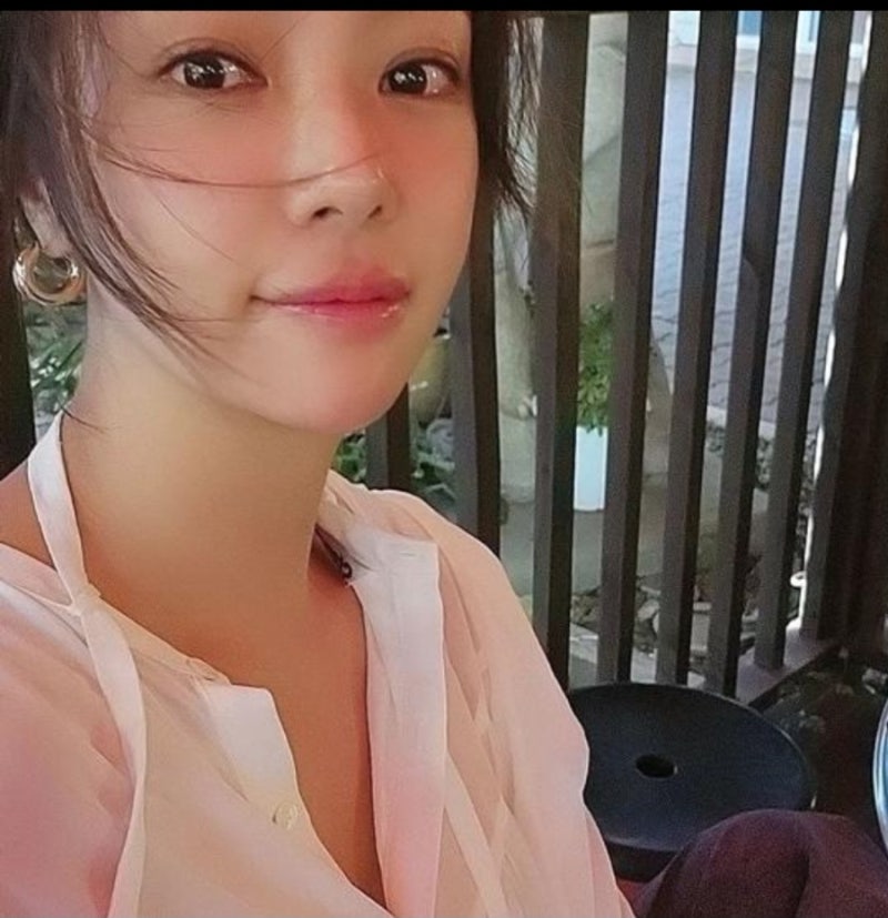 황정음 얼굴이 달라졌다? 사진 보고 깜짝…본인도 “어떡해” 한 최근 모습