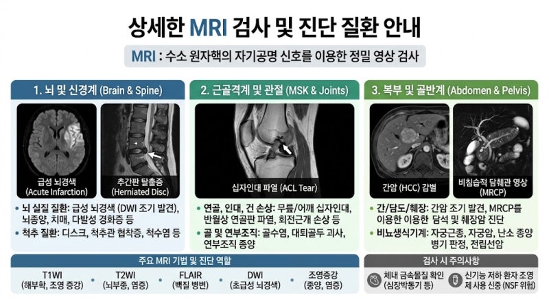 MR검사(MRI. MRA. MRV) 검사법 구분 아시나요!