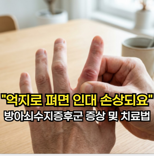 방아쇠수지 증후군, "억지로 펴면 인대 손상되는" 방아쇠수지 증후군 증상 및 치료법