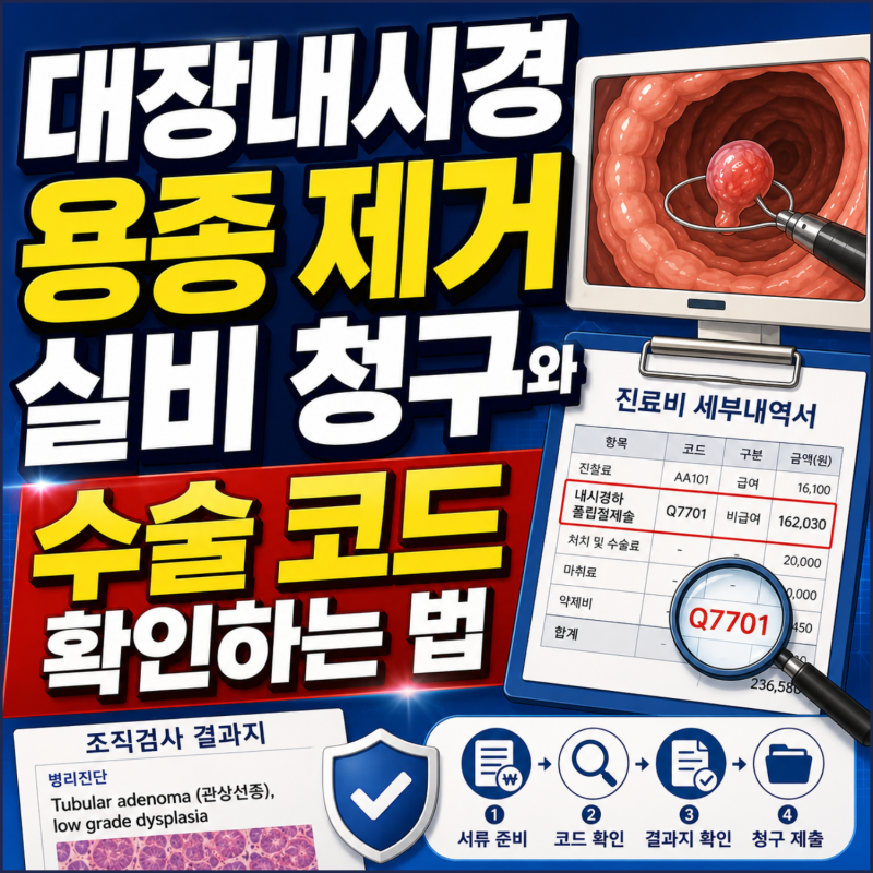 대장내시경 용종 제거 실비 청구와 수술 코드 확인하는 법