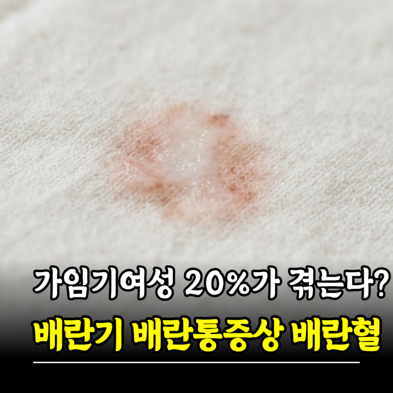 가임기 여성 20%가 겪는다고? 배란기증상 배란통증상 배란혈 제대로 알기