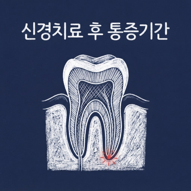 신경치료 후 통증기간과 신경치료후에 크라운 씌우는 이유