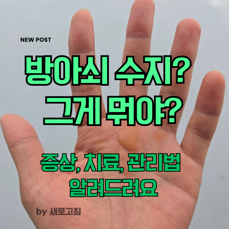 손가락이 안 펴지고 '딱' 소리가 난다면? 50대 아저씨가 직접 겪은 방아쇠수지 증상과 치료·....
