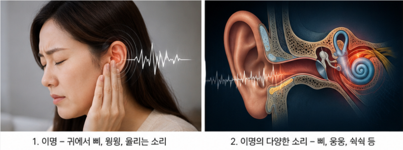이명 귀에서 심장소리, 삐·웅웅 소리까지 그냥 넘기면 안 되는 이유