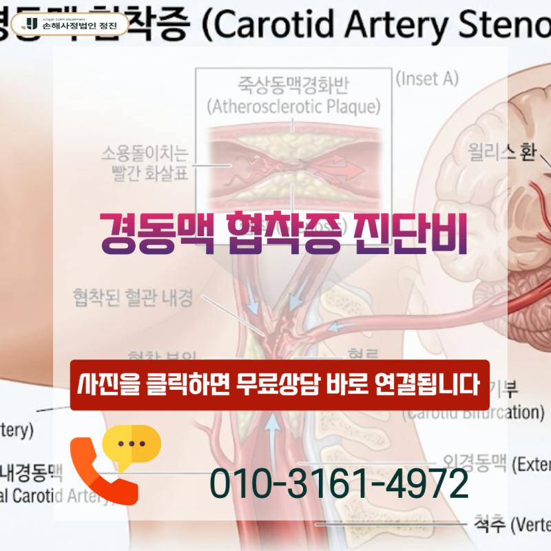 경동맥 협착증 진단비 I65.2 코드 진단서 받고도 보험금 전액 거절당했다면 어떻게 대응해야 ....