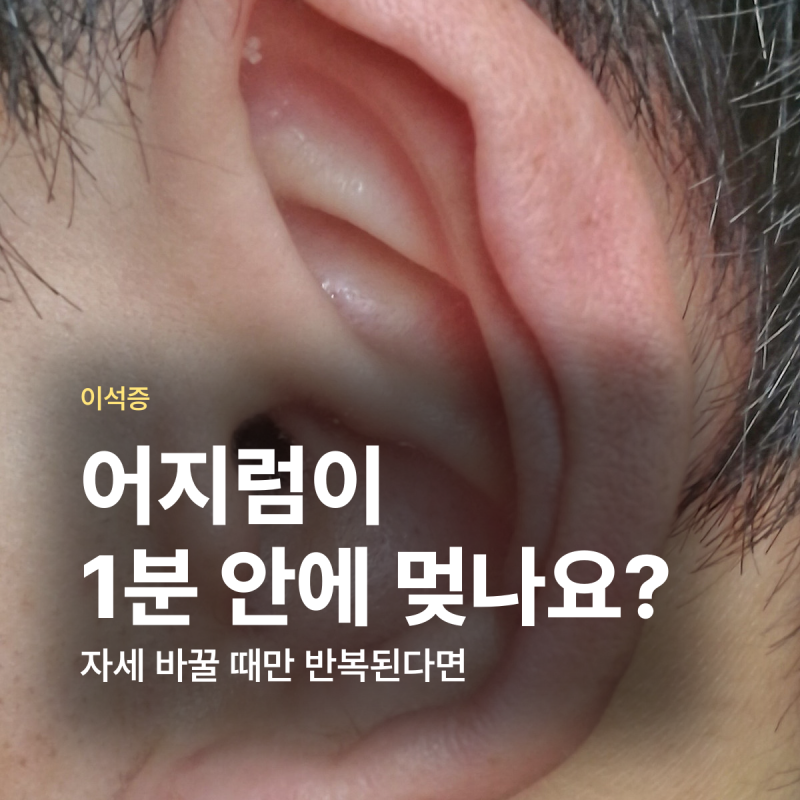 이석증 증상 원인 치료법 자가치료 병원 정리