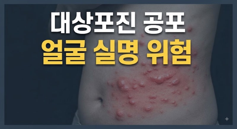 대상포진 초기증상부터 원인, 부위별 위험도, 전염성, 추천 병원까지 총정리!