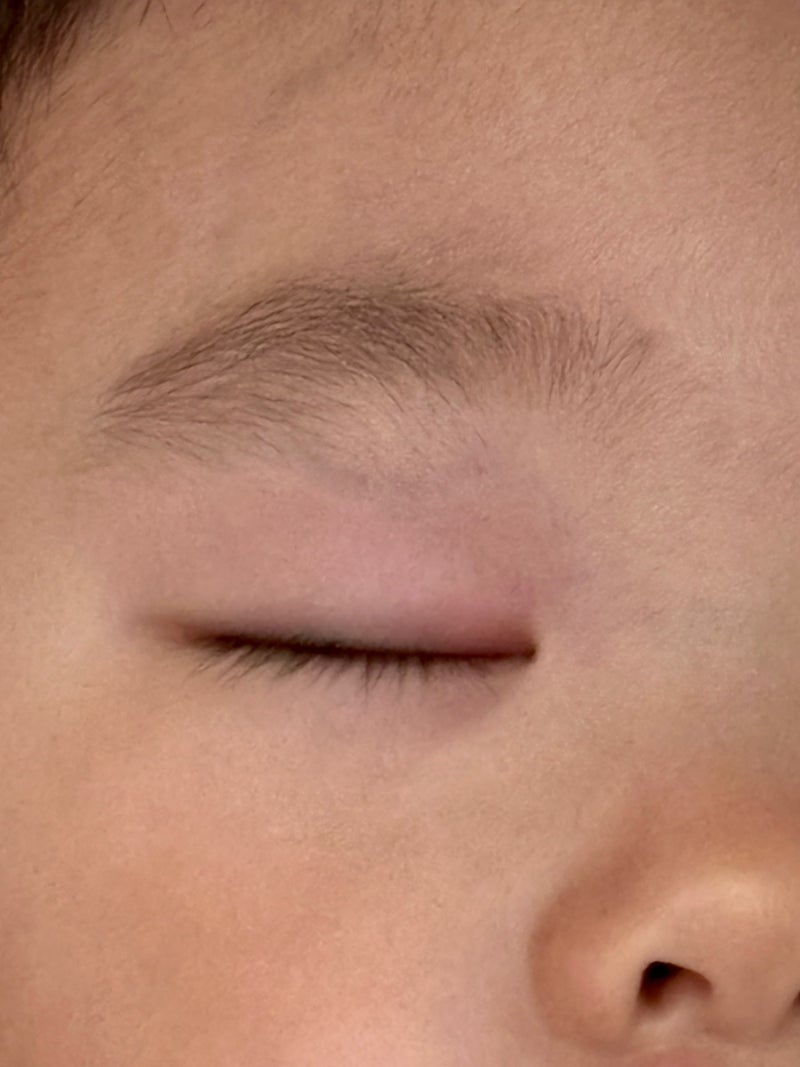 아기 눈곱이 많이 껴요 결막염일까? 원인부터 확인하는 방법 총정리