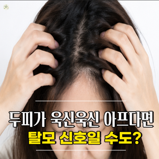 두피통증 이유 증상 탈모 병원, "머리카락만 스쳐도 아픈 이유!"