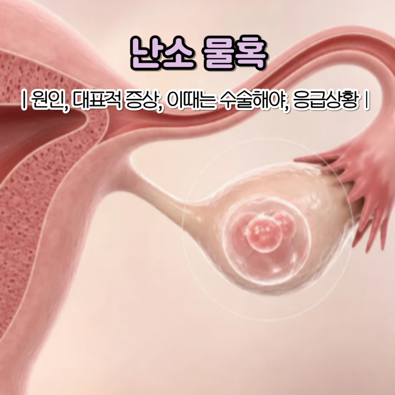 난소 물혹 증상 원인부터 수술까지 알아둬야 할 일들