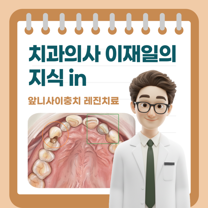 앞니사이 충치치료 레진, 통증 변색 있을까? 비용 가격 후기 총정리