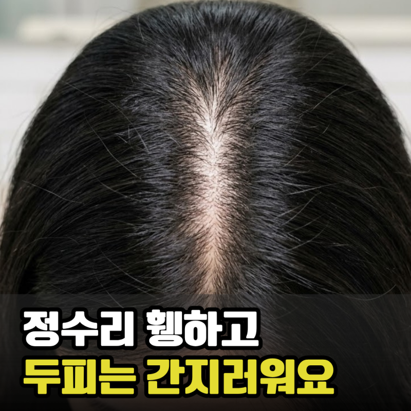 매일 아침 바르는데 앞머리떡짐 없을까? 바이브랩 영양 앰플 4주효과?