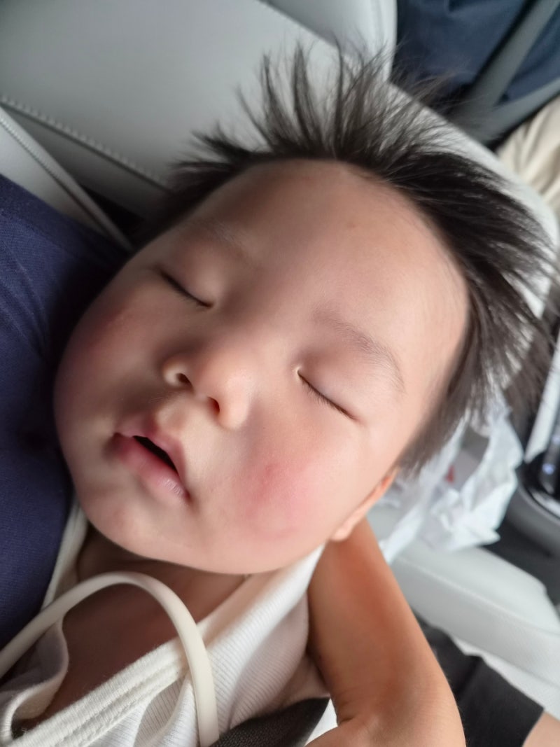 8개월 9개월 둘째 남자아기 항문농양 재발(미열, 항생제, 에스로반)