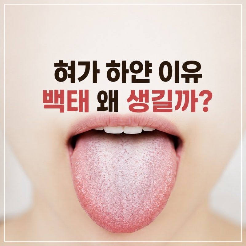 혀가 하얀 이유, 백태 왜 생길까? 백태 없애는 법