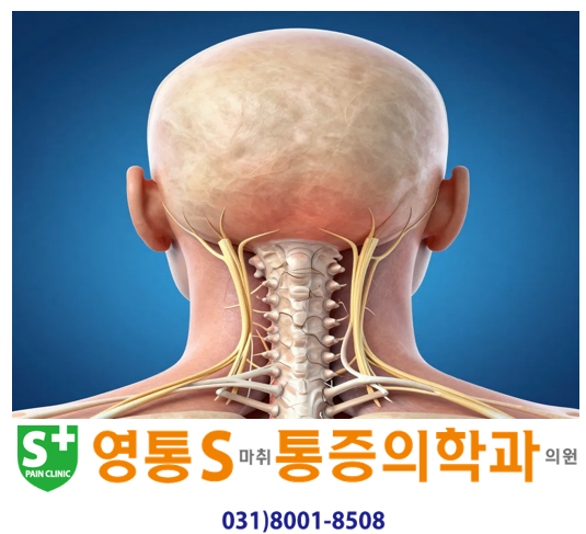 후두신경통(뒤통수 신경통)