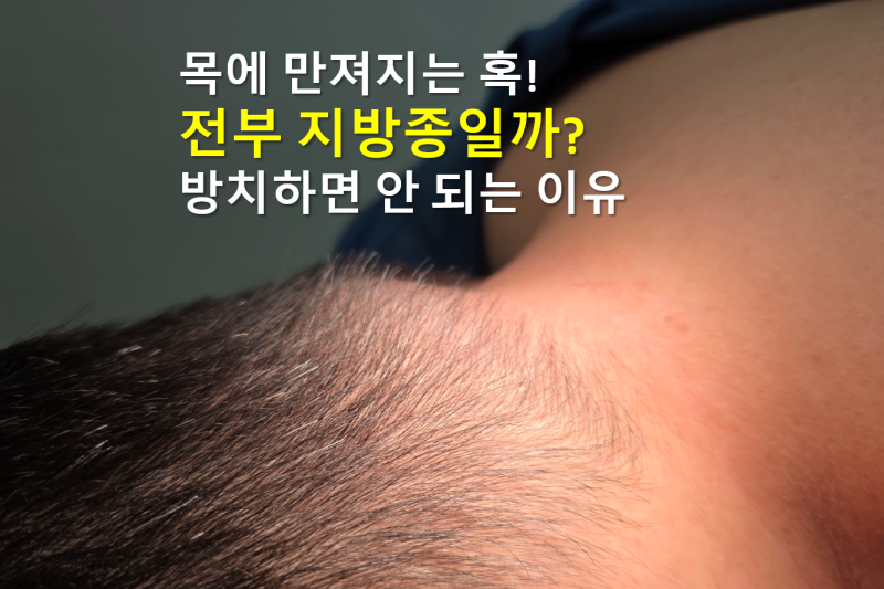 목 지방종 대표적인 피하 혹의 종류를 알아보자