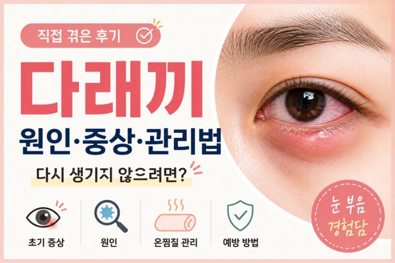 다래끼 원인 초기 증상 눈 부음 5일간 고생하고 알게 된 관리법