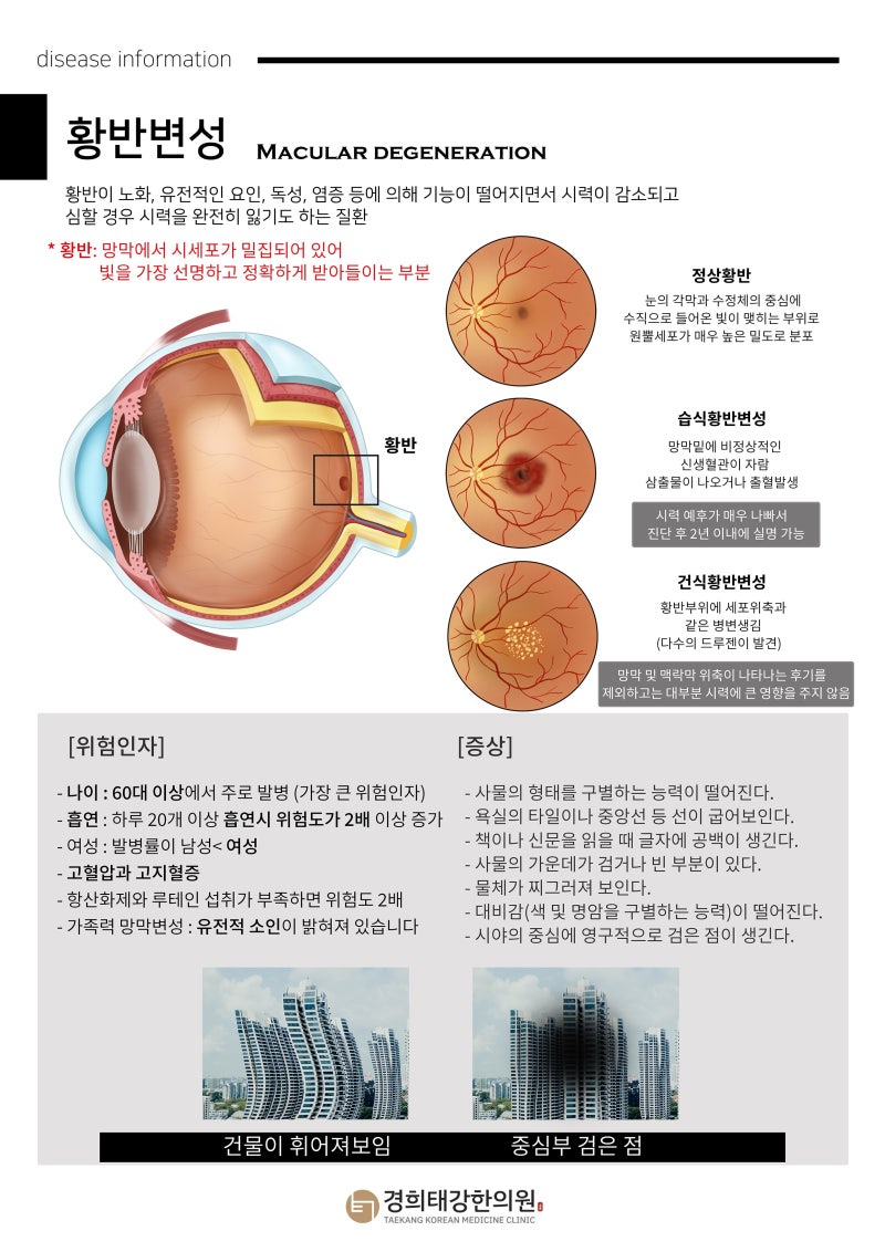 눈 영양제, 정말 효과가 있을까요? 루테인·지아잔틴·아스타잔틴·오메가3 효과와 부작용 총....