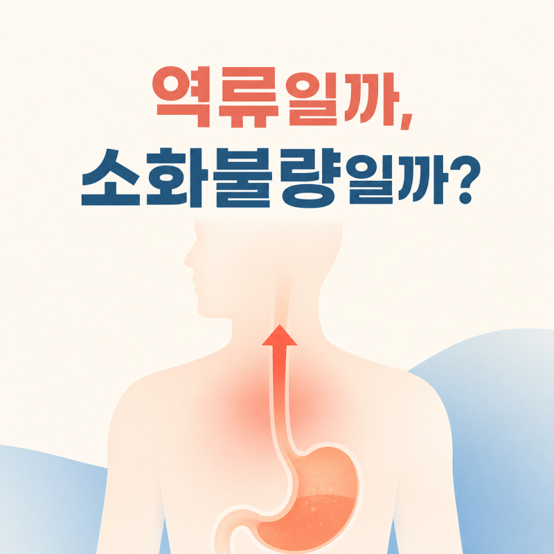 역류성식도염증상, 단순 소화불량과 어떻게 다를까?