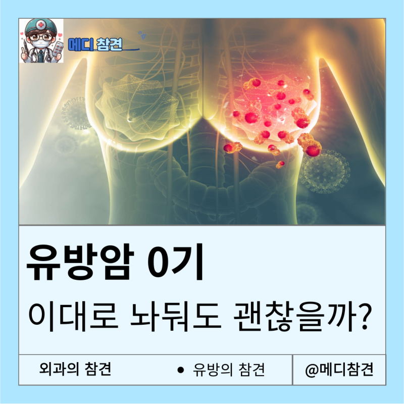 유방암 0기, 관상피내암 DCIS 소엽상피내암 LCIS 의학용어