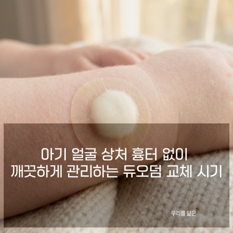 아기 얼굴 상처 흉터 없이 깨끗하게 관리하는 듀오덤 교체 시기