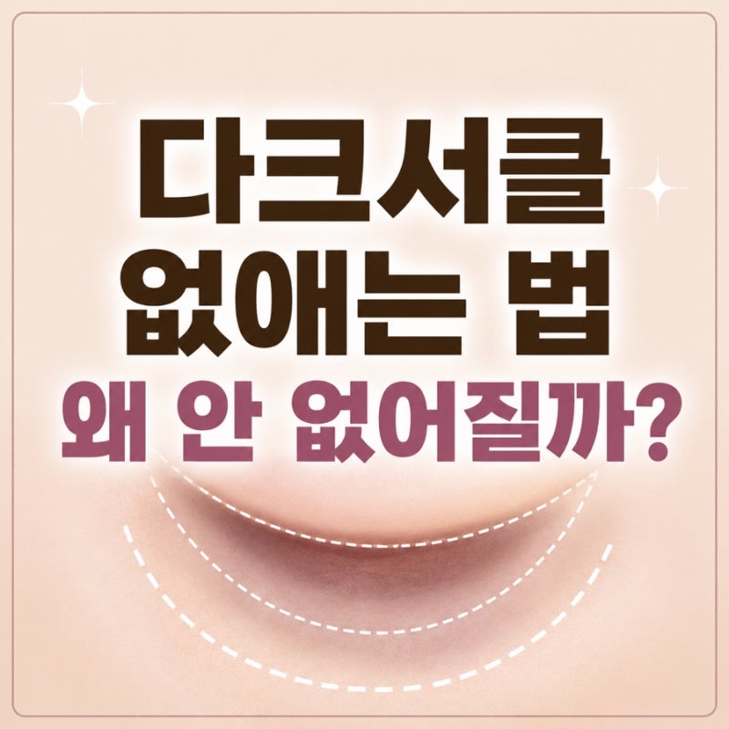 다크서클 없애는 법 -색깔에 따라 이유가 다르다