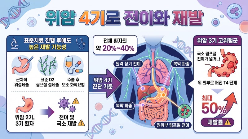 위암 2기, 3기 수술 후 4기 전이암 재발로 진행되는 기간과 증상