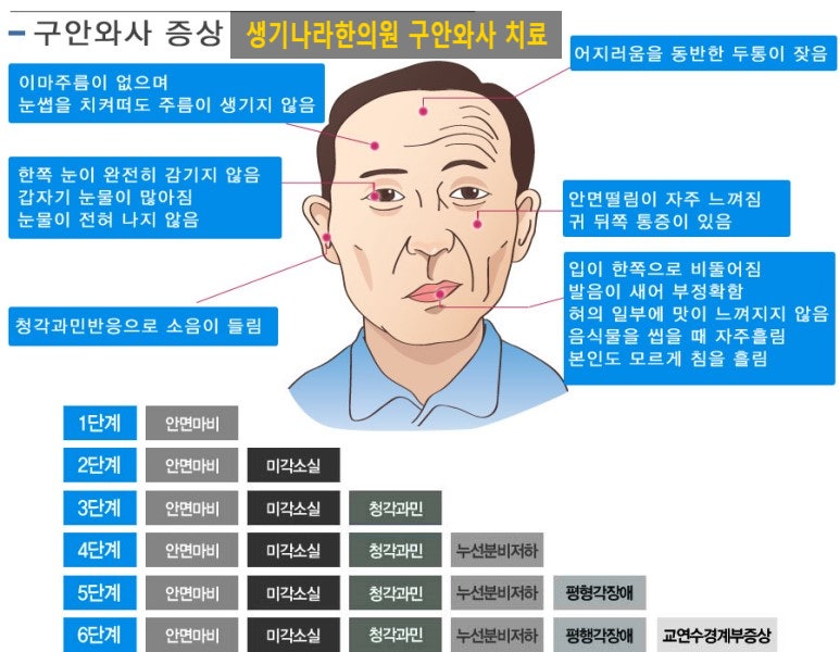 안면마비 치료 기간 어케 되나요... 한달째 진전이 없음 2023.10.28. 지식iN 상담기, 구안와사, 안....