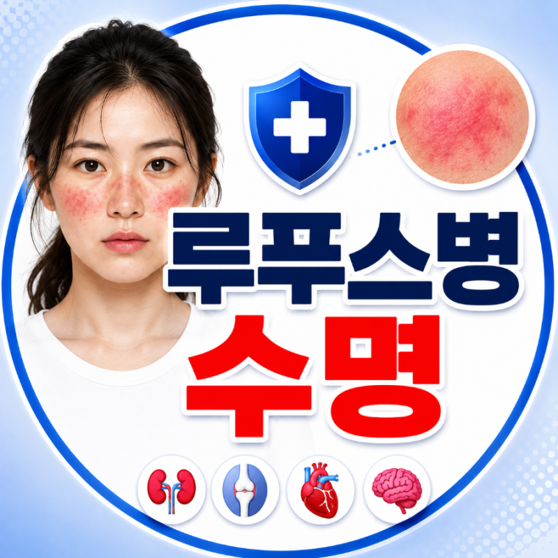 루푸스병 수명, 얼마나 살 수 있을까? 생존율과 예후