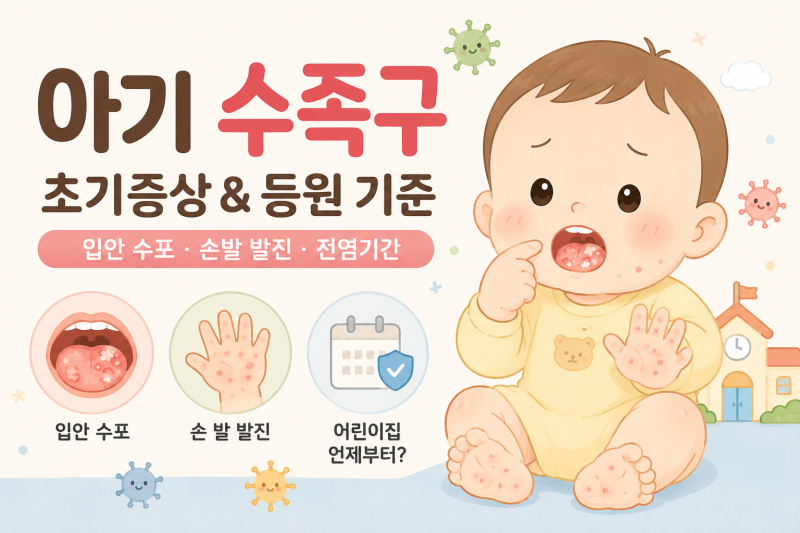 아기 수족구 초기증상 입안 수포부터 손발 발진까지, 어린이집 언제부터 갈 수 있을까?