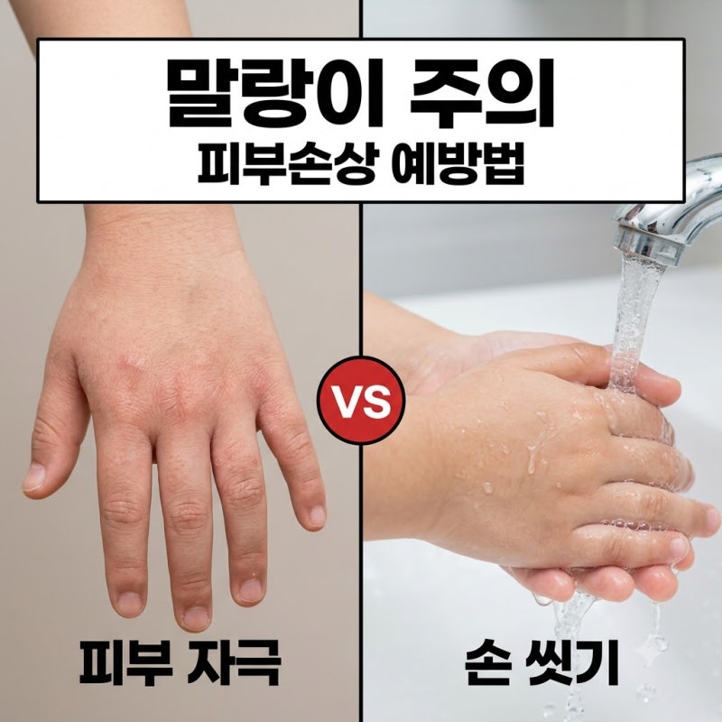 말랑이 피부손상 원인과 주요 증상! 손 가려움·화상 예방법 총정리