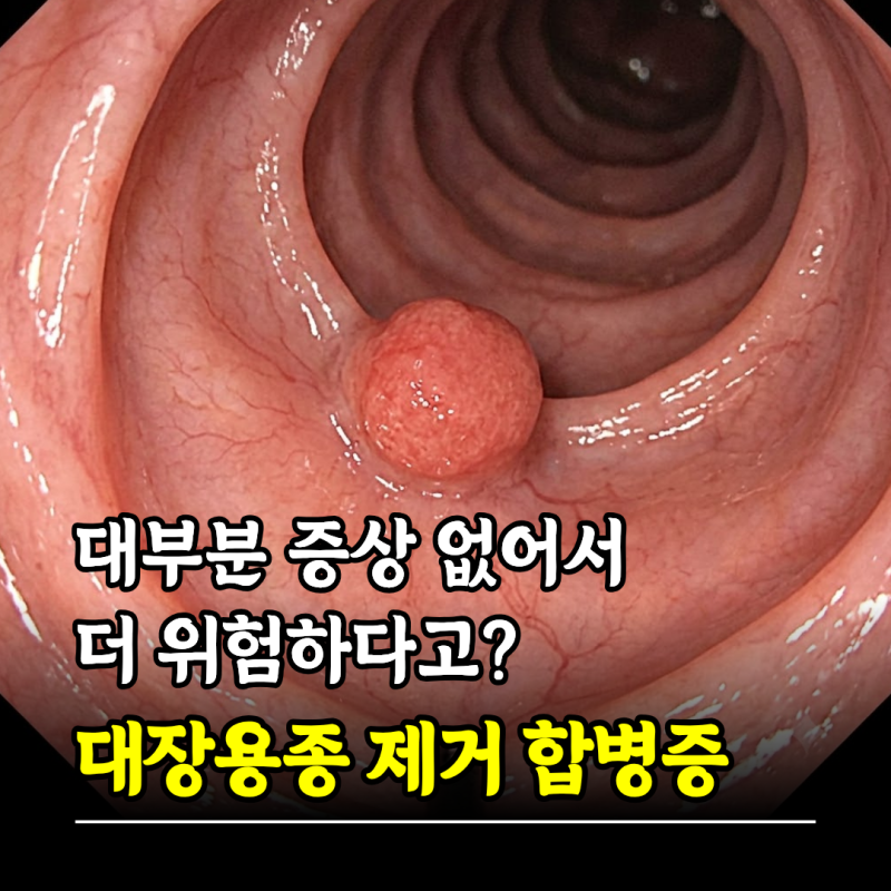"대부분 증상 없어서 더 위험하다고?" 대장용종 제거 방법 합병증