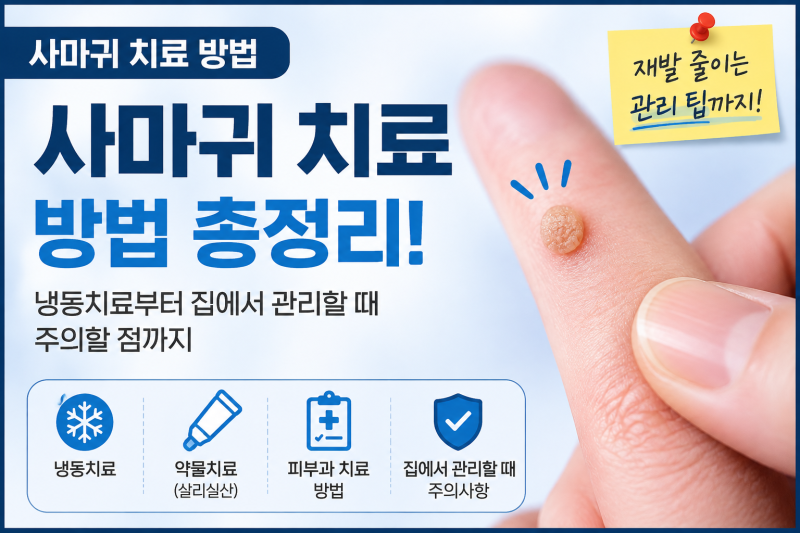 사마귀 치료 방법 총정리, 냉동치료부터 집에서 관리할 때 주의할 점까지