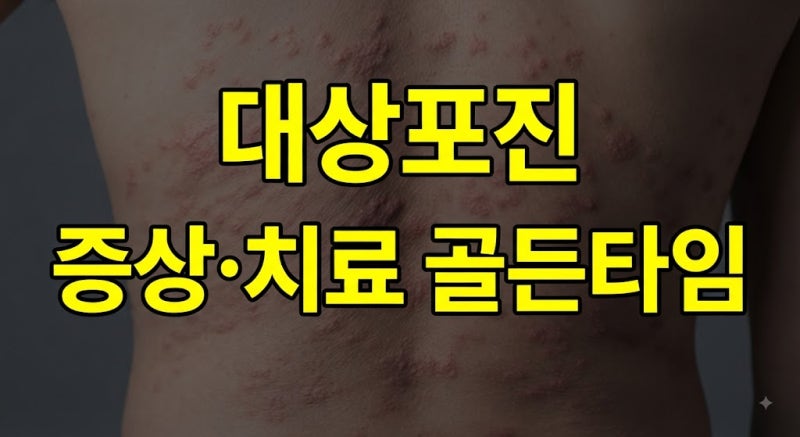 대상포진증상 초기 및 부위별(배·얼굴·허벅지·팔·등·다리·귀·두피) 특징 총정리
