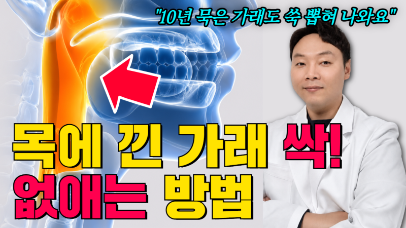 목에 가래 빼는법, 가래 생기는 이유와 없애는 방법
