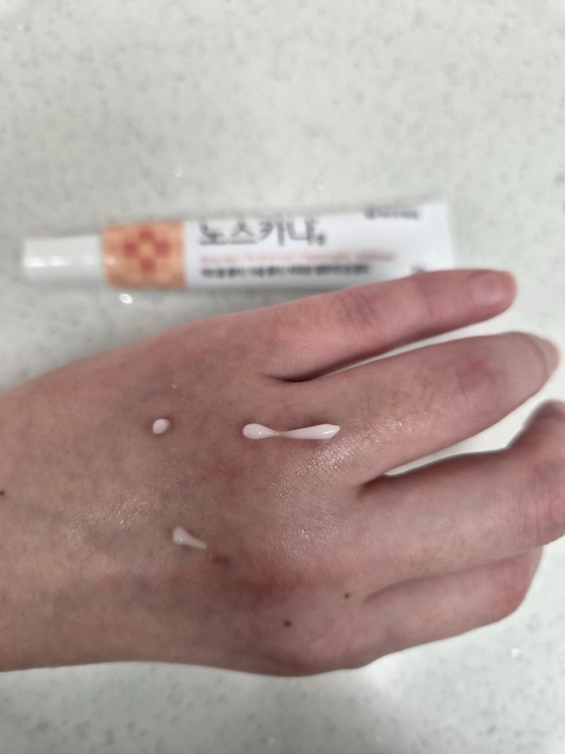 노스카나겔 사용법 흉터연고 직접 사용해본 후기