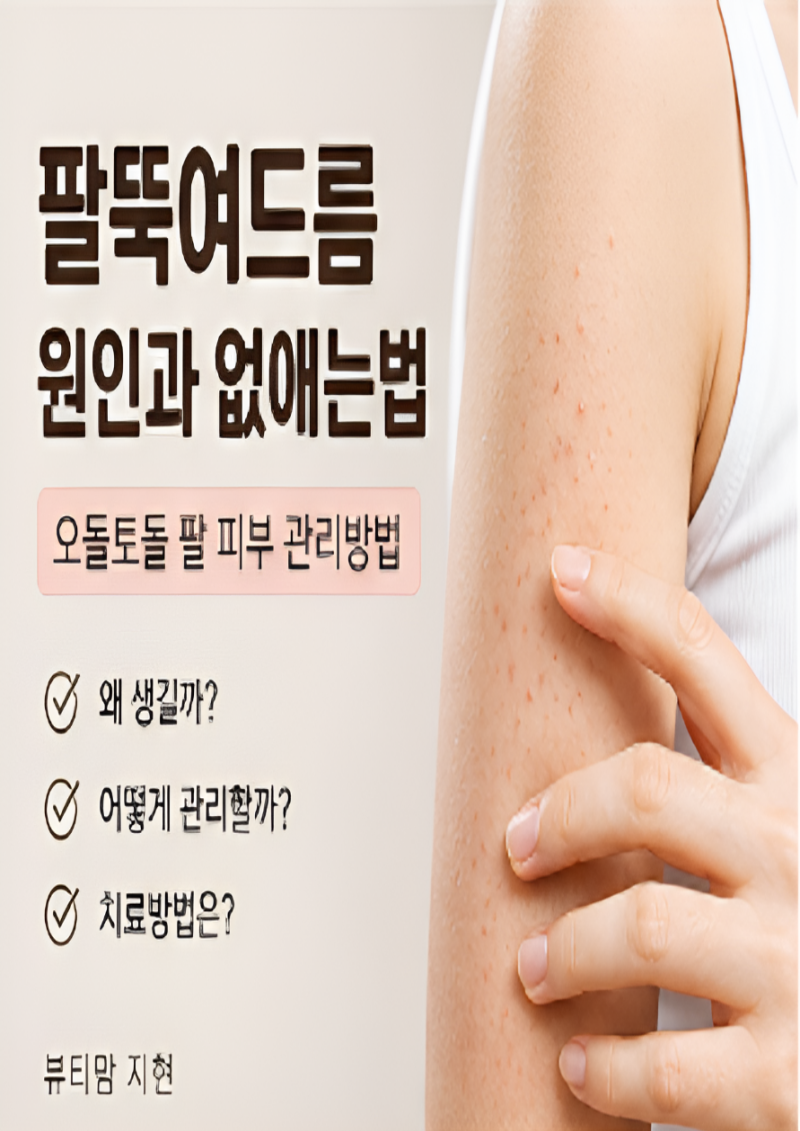 팔뚝여드름 원인과 없애는법, 오돌토돌 모공각화증 치료방법까지