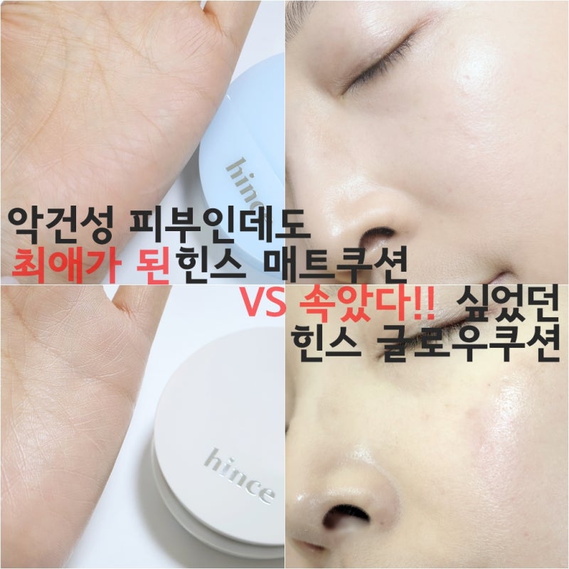 악건성피부도 속았다! 힌스 누글로우 화이트 쿠션 메쉬 매트 블루쿠션 비교