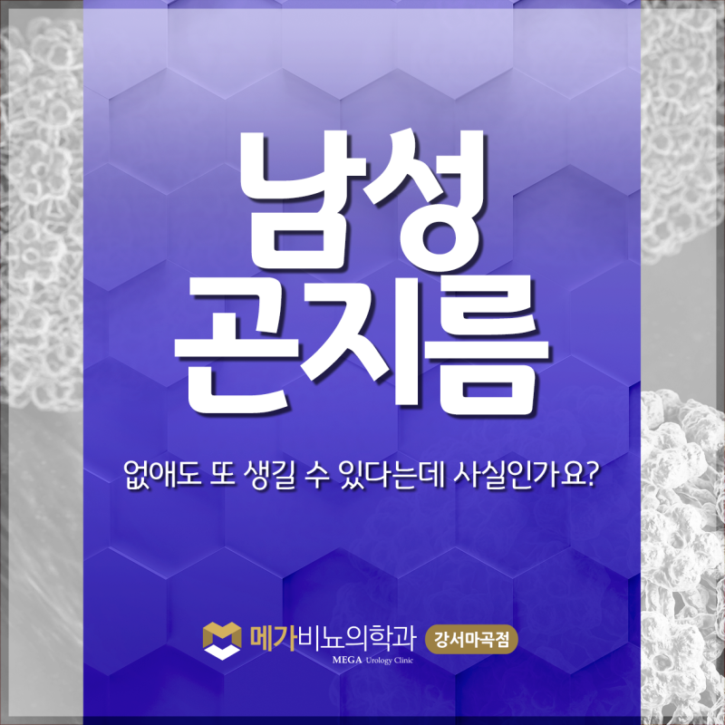 남성 곤지름, 없애도 또 생길 수 있다는데 사실인가요?