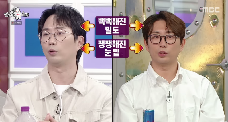 올라프 확정 뮤지컬 배우 이창호 눈밑지방재배치