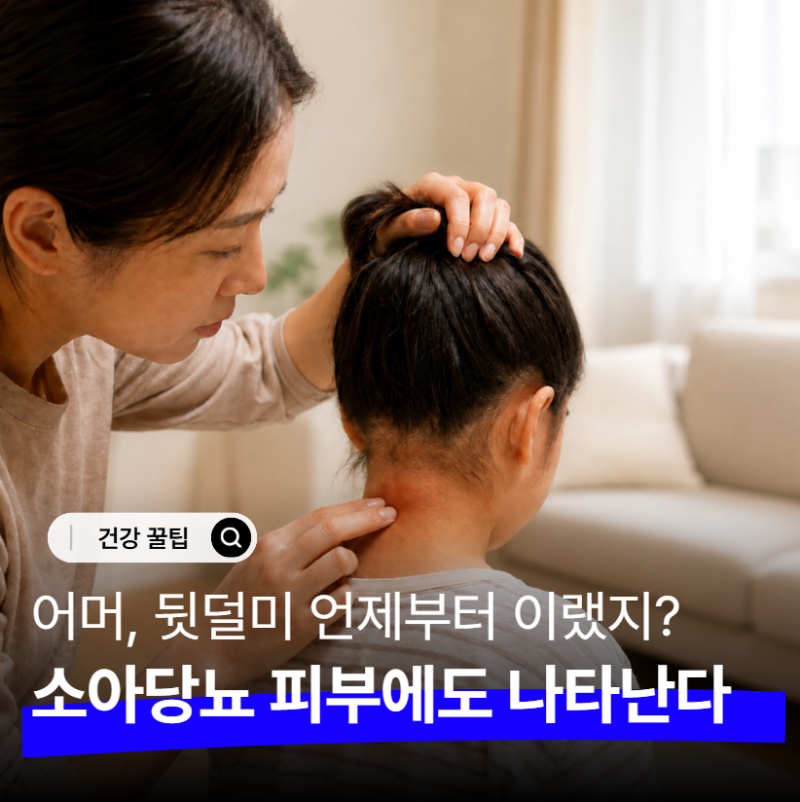 "우리애 목 겨드랑이가 왜 이렇지?" 소아당뇨 초기 증상, 그냥 넘기면 안되는 피부 변화