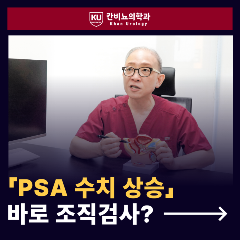 PSA가 높으면 무조건 전립선 조직검사를 해야 하나요?