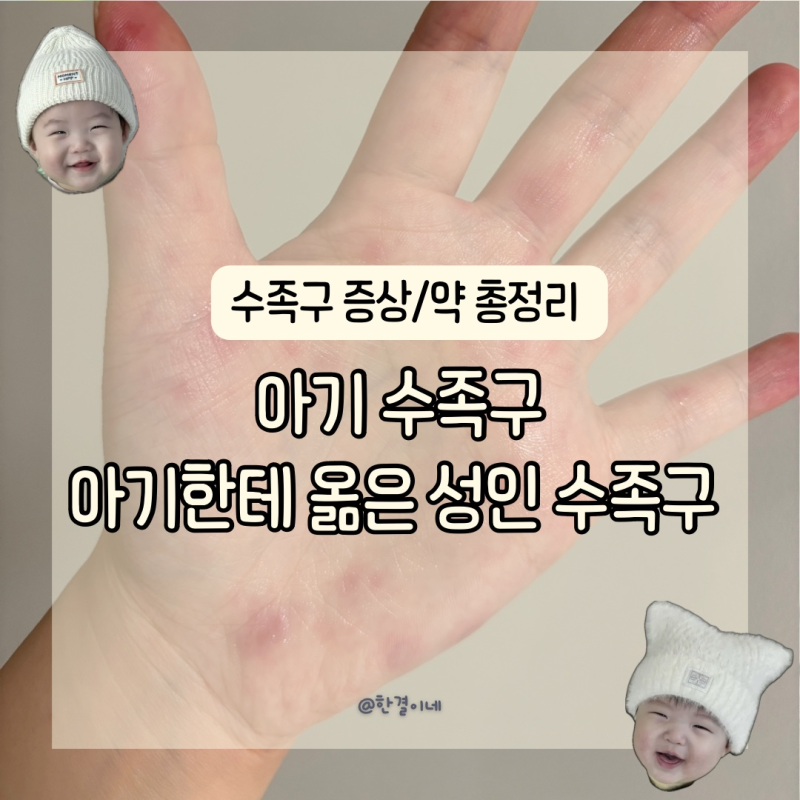 아기 수족구 성인수족구 아기한테 수족구 옮은 후기 수족구 증상순서 약 총정리