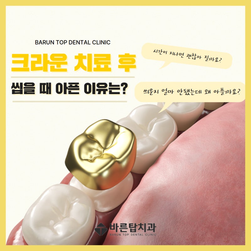 온양온천역 치과,크라운 치료 후 씹을 때 아픈 이유는?