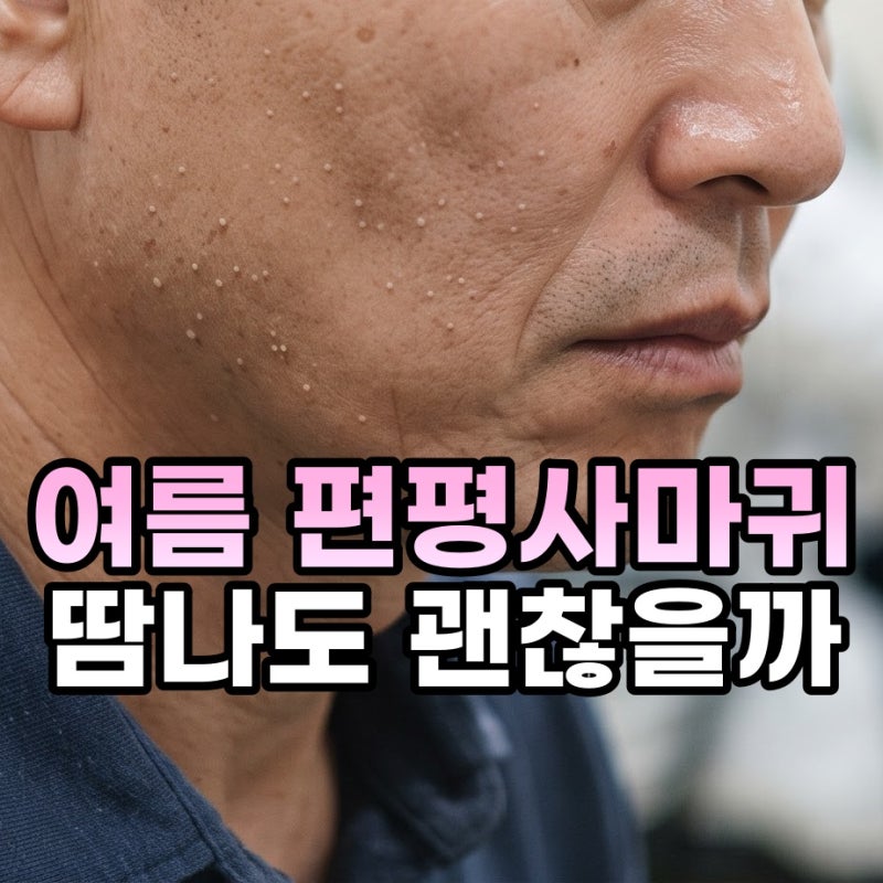 부평 편평사마귀 제거 여름에 해도 될까요? 땀 화장 때문에 걱정이 된다면
