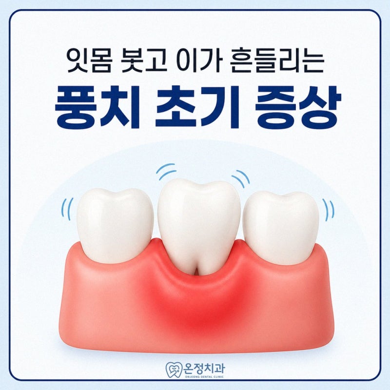 풍치 증상, 원인과 치료에 대해