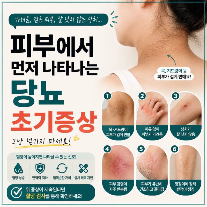 피부에서 먼저 나타날 수 있는 당뇨 초기증상 6가지