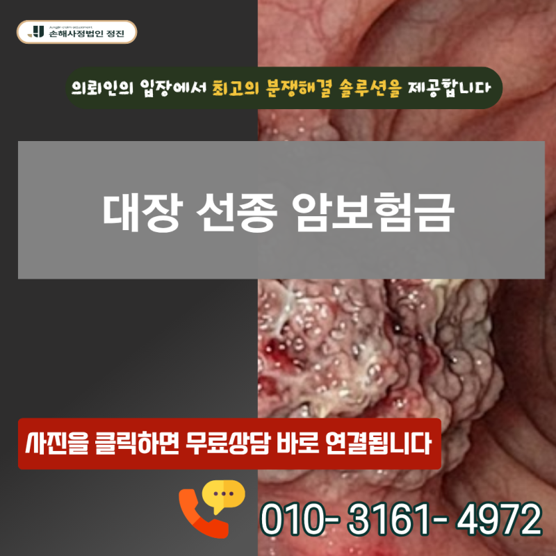 대장 선종 암보험금, D12·D01 코드인데 과연 일반암 전액 지급이 가능할까요?